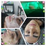 فیشیال تخصصی پوست و رفلکسولوژی و ماساژ پا برای بانوان